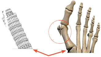 Leaning Tower of Pisa and Foot Graphic