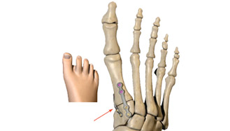 Secured foot 3d graphic