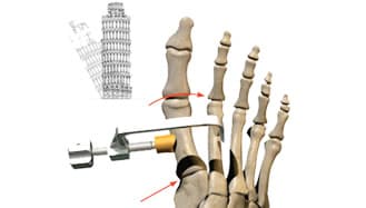 Leaning Tower of Pisa and Foot  Graphic